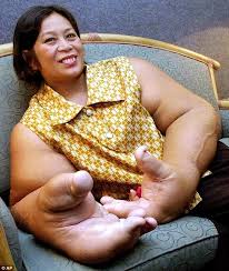 Check spelling or type a new query. Thai Woman S Hands Thought To Be Biggest In The World Daily Mail Online