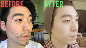 There are many celebrities with beauty marks that add more to their already glamorous personality. How To Hide Beauty Marks Without Makeup Saubhaya Makeup