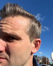 Wrinkles should merely indicate where smiles have been.” -Mark Twain. But  what does hair loss indicate, Twain?