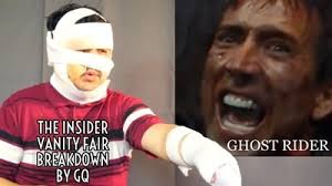 Burn Expert Reviews Burn Injuries in Movies