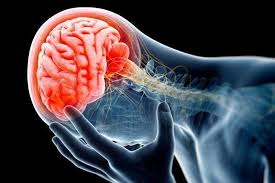 Related online courses on physioplus. Mtbi Concussion Treatment In Toronto Physiomobility