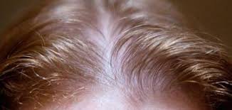 أسباب بطء نمو الشعر حياتك