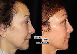 Dr. Mune Gowda, MD, FACS added...