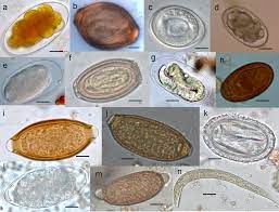 Nematode Nematode Intestinal Parasites Liver Fluke