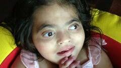 Disabled N.J. girl thrives, inspires after transplant