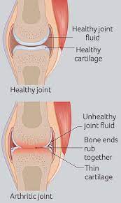 Arthritis In Dogs Pdsa