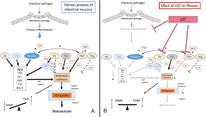 Ustekinumab crosses the placenta (klenske 2019; Ustekinumab Is Effective Against Small Bowel Lesions In Crohn S Disease Two Case Reports Springerlink