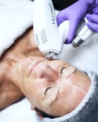 Read everything to know before undertaking tixel treatment with the tweakments guide. Tixel Kosmetikstudio Jescava In Nurnberg