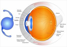 Selecting An Intraocular Lens Iol Ophthalmic Consultants Of Vermont