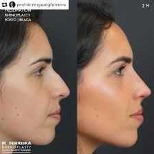 🥼🩺 Dr. Milos Kovacevic 🥽 @dr.miloskovacevic ✓ Location: Hamburg, Germany  ☝️Website: www.dr-kovacevic.de ⭐️ 🌟 ⭐️ 🌹Our mission at  @facialplasticsphotos is to make quality information