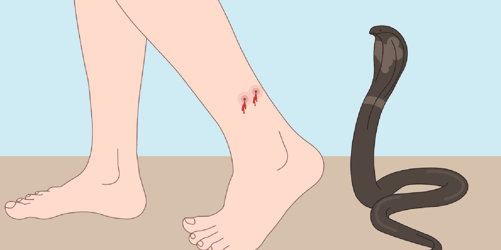 Snake Bite