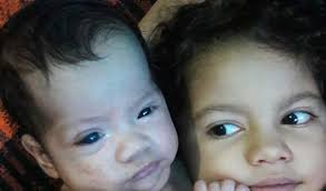 CIRURGIA DO OLHO DA ISABELLA