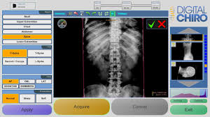 Acquisition Software For Digitalchiro Digital X Ray Systems Works With Both Cr And Dr Systems Digital How To Apply Lower Extremity