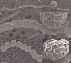 Image result for Exotheca