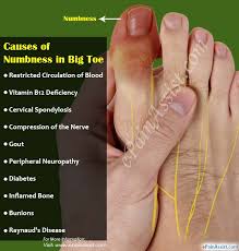 A numb or callused big toe is a common problem that can often easily be treated. Causes Of Numbness In Big Toe Its Treatment