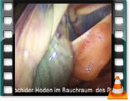 Klopphengst — klopphengst, klopfhengst, spitzhengst, ein hengst mit leistenhoden. Abdominaler Kryptochide Tiermedizin Hochmoor