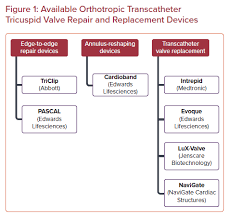 Transcatheter Procedures For Tricuspid Valve Regurgitation