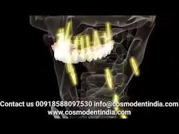 الزراعة الفورية للاسنان في 3 أيام بالهند مع الدكتور أمان أهوجا edison light bulbs light bulb edison