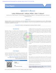 Pdf Quincke S Disease