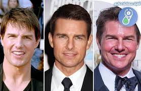 🔴» نمط تجميلي رائج #التكساس! ماذا تعرفون عنه؟ وهل له مساوئ؟ » جميع  المعلومات عنه تجدونها بعد قليل في التعليقات. د. علي حيدر لـ فريق سماعة حكيم  سماعة حكيم الإعلامية