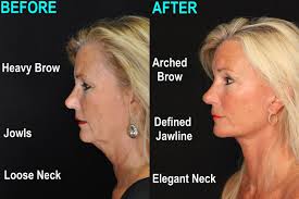 The perfect gift for your mom! Give or get a Mother's Day Alle gift card.  They can save $50