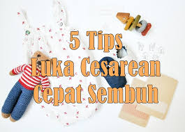 Luka dari pembedahan ketika bersalin sangat fragile, mudah sangat dijangkiti kuman atau terbuka semula jika tersalah cara saya sapu kunyit dan manjakani doktor. 5 Tips Luka Pembedahan Cesarean Cepat Sembuh Vitamin Semulajadi
