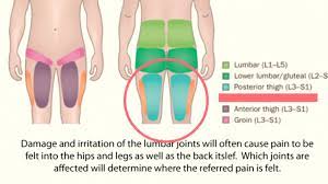 Stop Stretching Your Tight Hamstrings