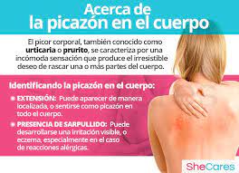 Picazon En El Cuerpo Prurito Shecares