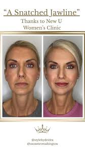 Dr. Scott Mosser's Top Surgery Reviews