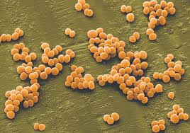 Stafilococul auriu reprezinta o bacterie de tip patogen ce face parte din clasa staphylococcus. Ce Este Stafilococul Auriu Èi De Ce Este Periculos Pentru Oricine