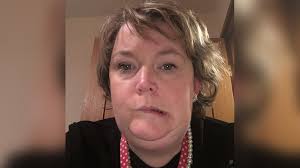 Diffyg dealltwriaeth o barlys 'erchyll' ar yr wyneb