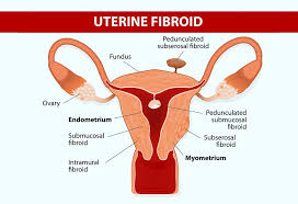 Image result for uterus