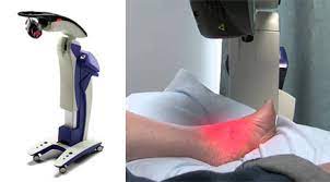 Mls Laser Therapy Foot Doctor Los Angeles West Hollywood Ca 90048