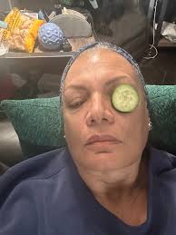 cucumber eye treatment interrupted by dog