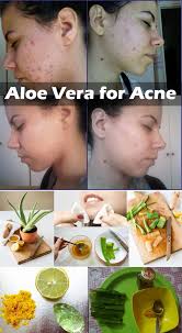 Pin On Aloe Vera Plant Its regular usage provides clean and clear skin while controlling oil & acne from skin. pin on aloe vera plant