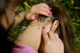 We did not find results for: Maladie De Lyme Morsure De Tique Tout Ce Qu Il Faut Savoir