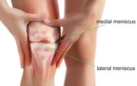 Proprietățile sale sunt cunoscute ca fiind eficiente împotriva pierderii supleții pielii și a formării ridurilor, pe sunt primele fiole cu acid hialuronic pe care le folosesc acasă, astfel că am rămas uimită de eficiența tratamentului. Preparate Pentru Artroza Recenziei Genunchiului Tratamentului Artroza Genunchiului Aertal Recenzii Preparate Pentru Artroza Genunchiului