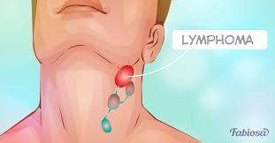She is wearing doctor's clothes and he is wearing casual clothing. 9 Warning Signs Of Lymphoma To Pay Attention To