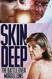 Amazon.com: Skin Deep: The Battle Over Morgellons : Pi Ware, Cindy Casey,  Steven R Feldman, Harry Quinn Schone, Pi Ware, Pi Ware, Laura Stoddard,  Patrick Belton, Gary Leva, Lev Mergian: Movies &