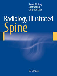 Radiology Illustrated Spine Ebook Radiology Ebook Download Books