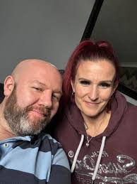 Recovery from PAO surgery and return to work