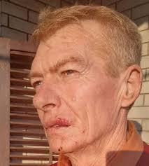 Šef voznog parka čekićem udarao vozača saniteta u Leskovcu