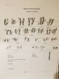 Student exploration human karyotyping gizmo answer key. Student Exploration Human Karyotyping Humankaryotypingse Doc Name Darren Date Student Exploration Human Karyotyping Vocabulary Autosome Chromosomal Disorder Chromosome Genome Karyotype Sex Course Hero Chemically Inducing Cell Division Then