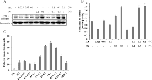 Function of metal detector and how do metal detectors work? Comparative Evaluation Of The Effectiveness Of Novel Hyaluronic Acid Polynucleotide Complex Dermal Filler Scientific Reports