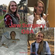 A double jaw surgery can help you get a more elegant and refined jawline. Jaw Surgery Faq Kimbermoose