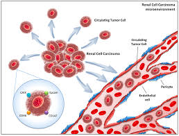 Chassin c., tourneur e., bens m., vandewalle a. Frontiers Circulating Tumor Cells In Renal Cell Carcinoma Recent Findings And Future Challenges Oncology