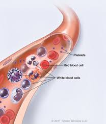 This group includes cancers of the bone marrow, blood, and lymphatic system, which includes lymph. Leukemia In Children Curesearch
