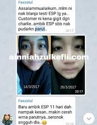 Parut jerawat berlubang boleh jadi berupa rata atau lekuk dan kadangkala berlubang. Ubat Parut Jerawat Yang Mujarab Kedai Vitamin Butterworth