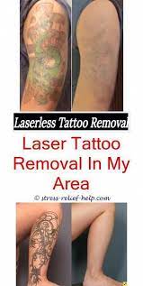 Tattoo Eraser Will Tattoo Removal Scar Low Cost Tattoo Removal Permanent Tatto Tattoos Tattooentfernung Haut Tattoo Tatowierungen