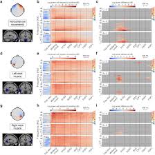 This group of muscles is found on the posterior thigh and flexes the knee. Mobile Brain Body Imaging Of Landmark Based Navigation With High Density Eeg Biorxiv